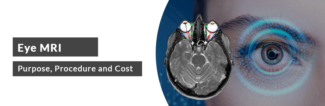 Eye MRI: Purpose, Procedure, Cost And Best MRI Centre In Delhi